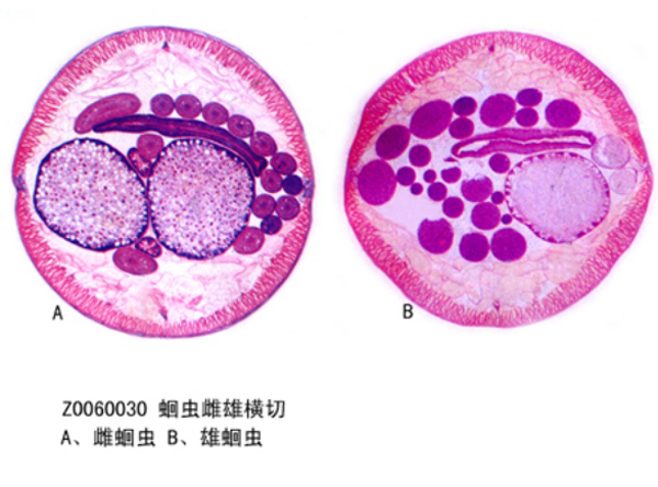 蛔蟲(chóng)雌雄橫切