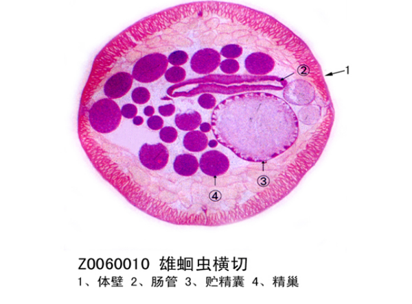 雄蛔蟲(chóng)橫切
